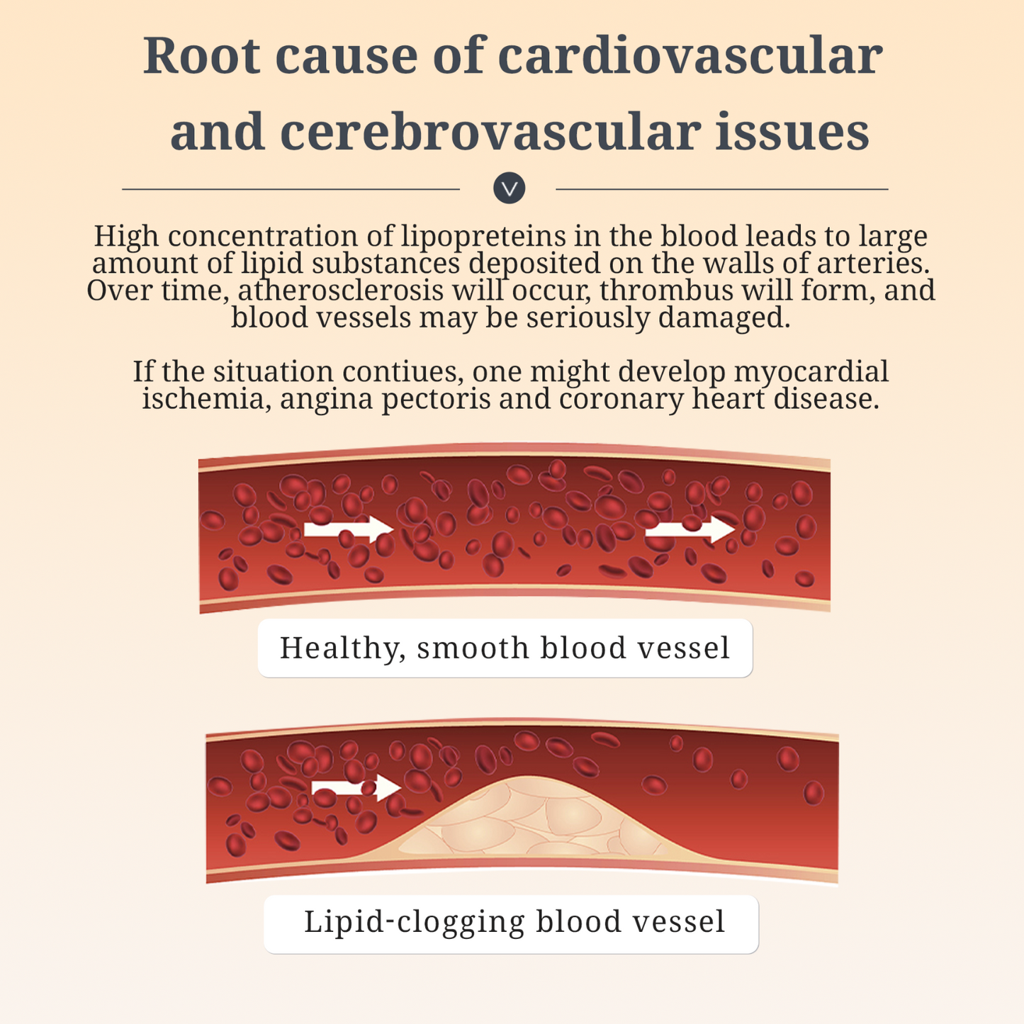 Cardiovascular Health - Natural Perilla and Tibetan Barley Oil. Support Heart & Blood Health, Enhance Brain Function, Boost Lipid Metabolism, Maintain Cholesterol Level, Natural Herbs Formula, 60 veggie capsules